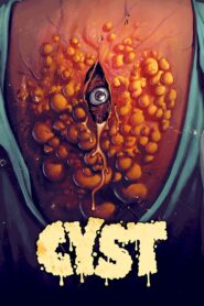 Cyst – Κύστη